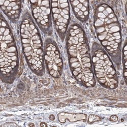 LARS2 Antibody, Novus Biologicals 25 &mu;L; Unlabeled:Antibodies, Polyclonal